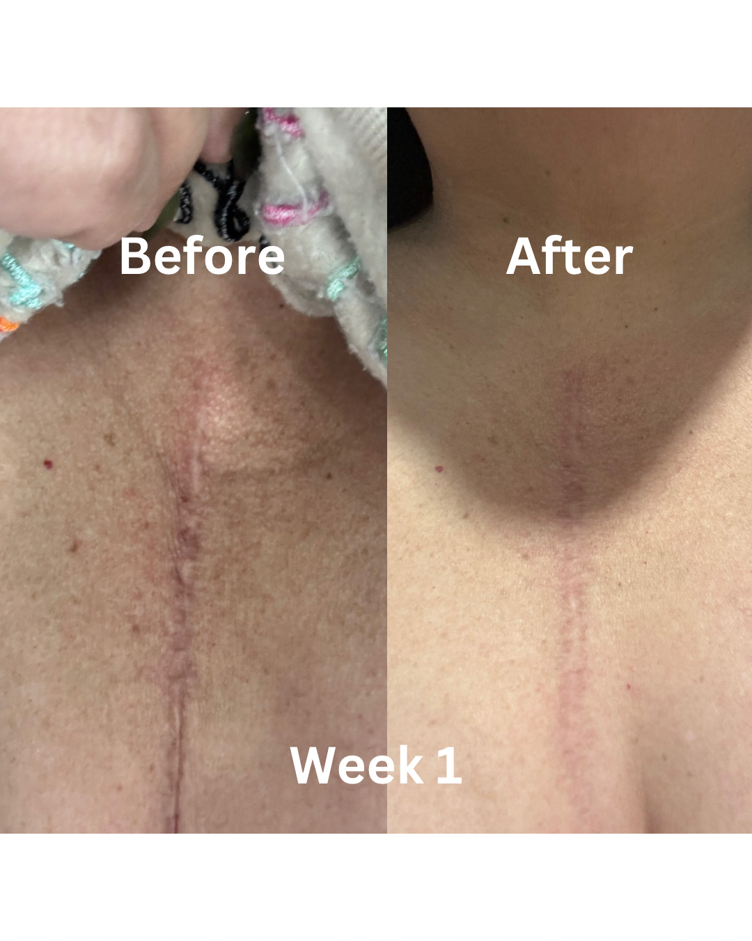 Anti-Aging Serum