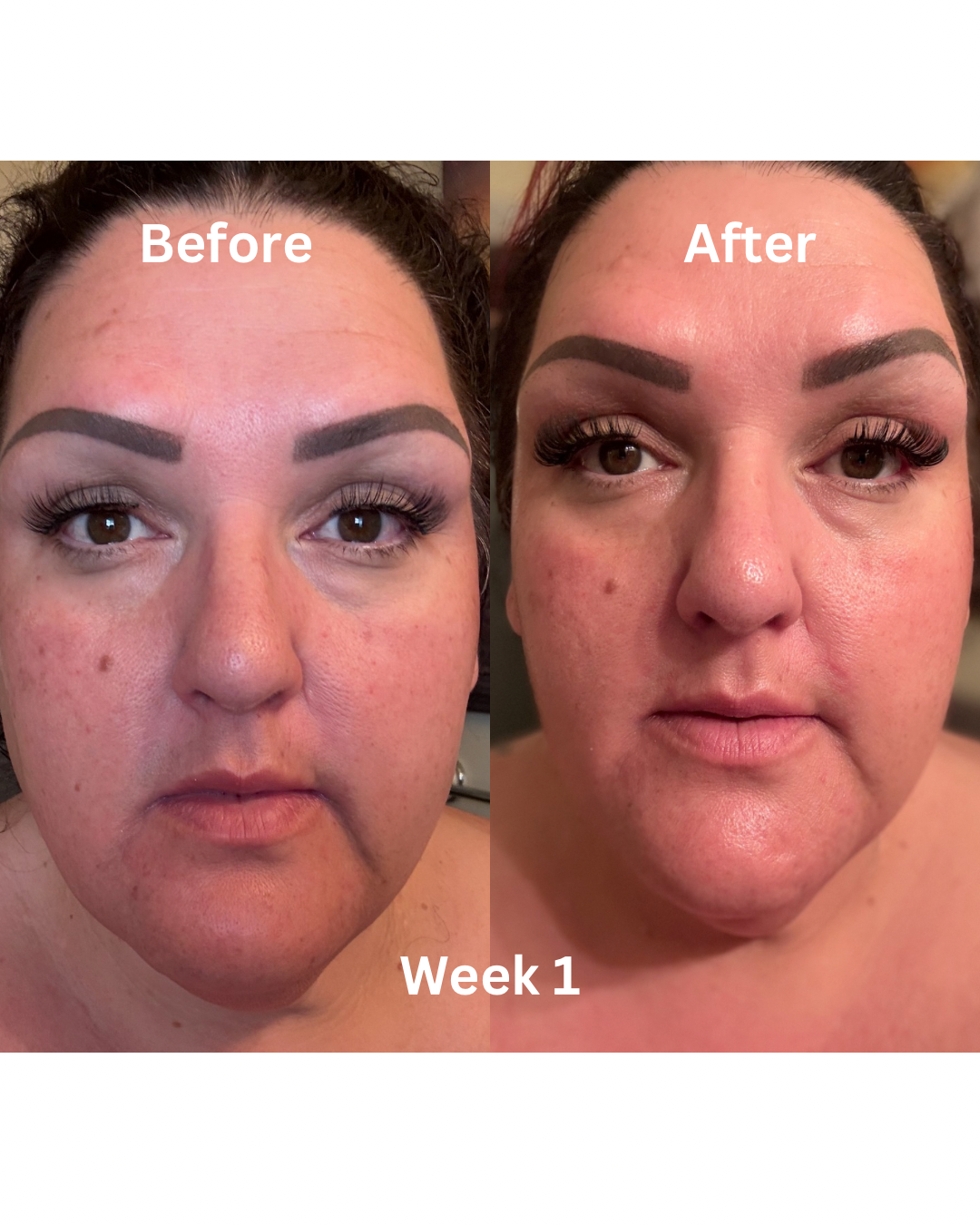 Anti-Aging Serum